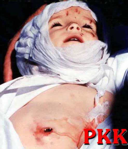 PKK: The Worst Enemy of Kurdish Interests