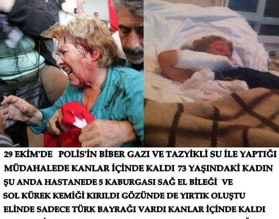 <p>
Cumhuriyet Bayramı kutlamalarının simge fotoğraflarından birinin sahibi olan 73 yaşındaki Hasibe Özbay şu an hastanede. 5 kaburgası, sağ el bileği ve sol kürek kemiği kırık. Gözünde de yırtık oluştu.AKP’lilerin “Marjinal”, Başbakan’ın “Holigan, terörist” diye nitelendirdiği Ankara’daki Cumhuriyet Bayramı kutlamalarına katılanlardan biri de 73 yaşındaki Hatice Özbay.35 yıllık bayrağını alıp Anıtkabir’e yürümek isteyen Hatice Özbay, polis barikatına takıldı. Polisin biber gazı, tazyikli suyla yaptığı müdahale sonrası kanlar içinde kaldı. Yasaklanmak istenen Cumhuriyet Bayramı kutlamalarının da simge fotoğraflarından birinin de sahibi oldu.</p>
Like · · Share 2,200 people like this. 3,970 shares 6 of 330
View previous comments - 29 mayisdan 20121