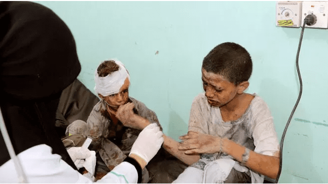 Yemen’de 130 bin çocuk hastanelerde tedavi altında