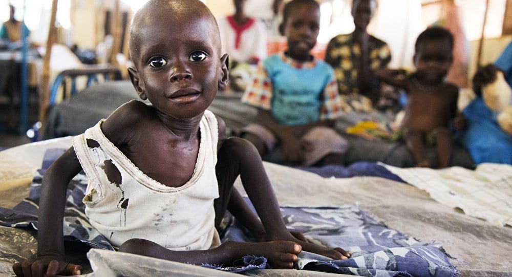 Güney Sudan’da çucuklar açlıktan ölüyor