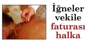 Akapunktur iğneleri Milletvekiline faturası Millete