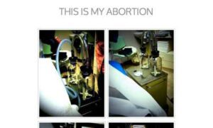 Benim Kürtajım (thisismyabortion)