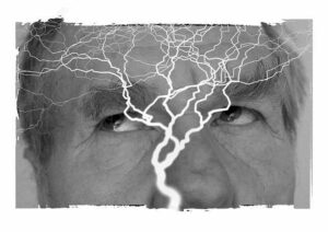 İsviçreli Doktor Açıkalın: Erdoğan epilepsi hastasıdır