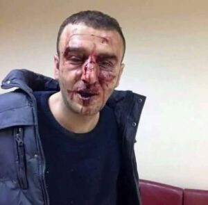 SEHIT ESLERI BIZE KALDI ,S.KERIM ISTEDIGIM KADARINI DIYE TWIT ATAN KISININ SON GORUNUSU