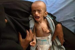 Yemen Katliamının Temelindeki Tezgâh