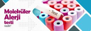 Moleküler Alerji Testi Nedir?