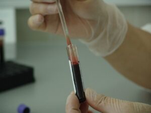 Yeni kan grubu keşfedildi: Çok sayıda hayat kurtarılabilir