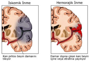 İnsan hafızasına dair yeni bakış açıları